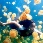 cara mengobati sengatan ubur-ubur