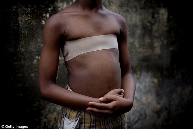 tradisi menghilangkan payudara dilakukan untuk para gadis di kamerun